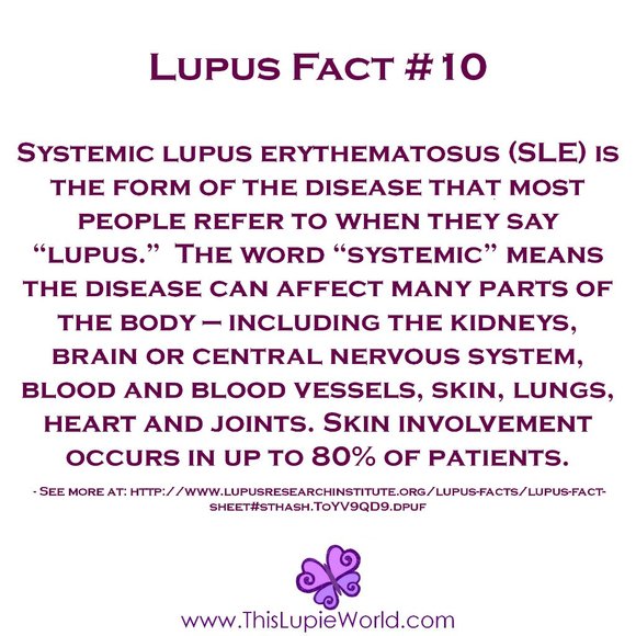 Meet your Posher, Shay - Picture 8 of 14